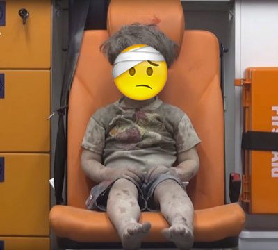 Syrian child hurt with injured emoji expression
