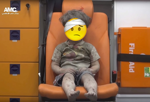 Syrian child hurt with injured emoji expression